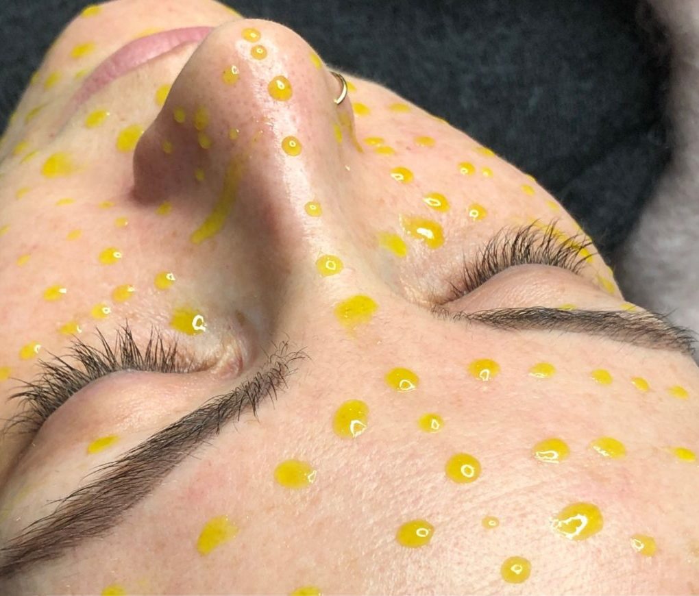 Biostimulation Revitalisierung