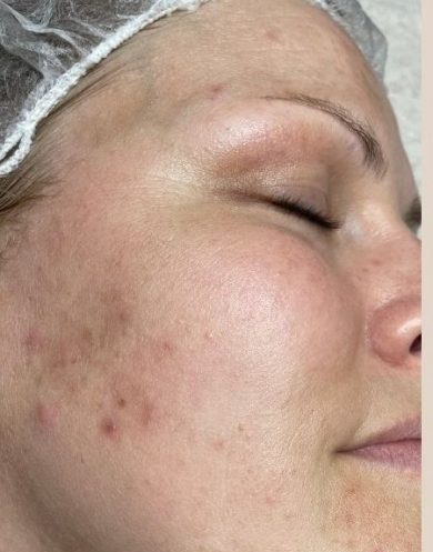 BIO 5 e1762339914434